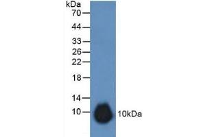 Detection of GREM1 in Rat Stomach Tissue using Polyclonal Antibody to Gremlin 1 (GREM1) (GREM1 anticorps  (AA 25-184))