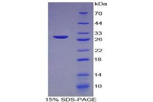 SDS-PAGE (SDS) image for Collagen, Type IV, alpha 2 (COL4A2) (AA 1487-1703) protein (His tag) (ABIN1879734)
