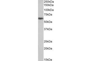 ABIN5539889 (1µg/ml) staining of U251 lysate (35µg protein in RIPA buffer). (PLAUR anticorps  (Internal Region))