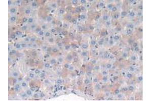 IHC-P analysis of Rat Liver Tissue, with DAB staining. (MME anticorps  (AA 286-428))