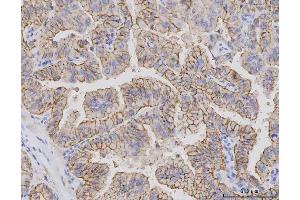 IHC analysis of Claudin 3/CLDN3 using anti-Claudin 3/CLDN3 antibody (ABIN7599625). (Claudin 3 anticorps  (AA 101-220))