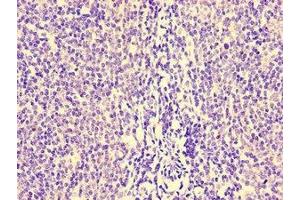 Immunohistochemistry of paraffin-embedded human lymph node tissue using ABIN7155534 at dilution of 1:100 (HCP5 anticorps  (AA 8-101))
