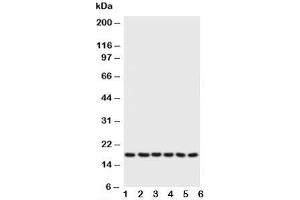 Western blot testing of Phospholamban antibody and Lane 1:  rat heart;  2: rat heart;  3: CEM;  4: MCF-7;  5: HT1080;  6: HeLa;  Predicted size: 18KD;  Observed size: 18KD