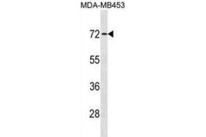 Western Blotting (WB) image for anti-Mex-3 Homolog C (C. Elegans) (MEX3C) antibody (ABIN3001399)