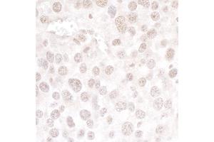 Immunohistochemistry (IHC) image for anti-hPrp3p (AA 100-150) antibody (ABIN7453461) (hPrp3p (AA 100-150) anticorps)
