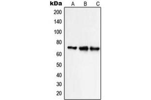 Western blot analysis of NHE9 expression in HepG2 (A), Caco2 HeLa (B), NIH3T3 (C) whole cell lysates. (SLC9A9 anticorps  (Center))