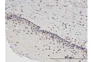 Immunoperoxidase of monoclonal antibody to RTKN2 on formalin-fixed paraffin-embedded human uterine cervix. (RTKN2 anticorps  (AA 1-163))