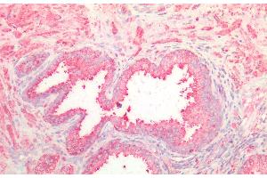 Detection of NOTCH2NL in Human Prostate Tissue using Polyclonal Antibody to Notch2 N-Terminal Like Protein (NOTCH2NL) (NOTCH2NL anticorps  (AA 1-236))
