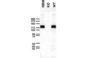 Immunoblot versus crude membranes from adult rat brain (RBM) and WT and Slo1 KO mouse brains probed with L6/60 TC supe.