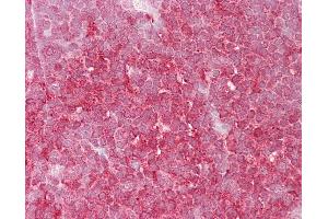 Anti-MCM6 antibody IHC of human thymus.