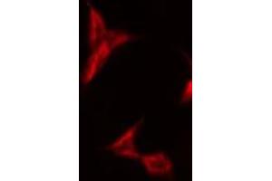 ABIN6275571 staining HeLa by IF/ICC. (SIRPB1 anticorps)