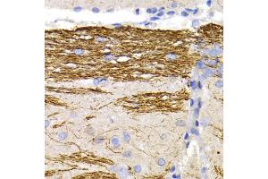 Immunohistochemistry of paraffin-embedded rat brain using NEFL antibody. (NEFL anticorps)