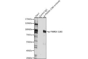 Immunoprecipitation analysis of 200 μg extracts of HeLa cells, using 3 μg Phospho-p90Rsk/RSK1/RPS6K-S380 pAb (ABIN6135275, ABIN6136172, ABIN6136173 and ABIN6225586). (RPS6KA1 anticorps  (pSer380))
