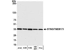 Western Blotting (WB) image for anti-Transmembrane Protein 173 (TMEM173) (AA 329-379) antibody (ABIN7449665) (STING/TMEM173 anticorps  (AA 329-379))