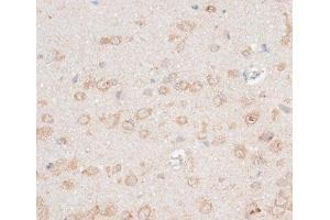 Immunohistochemistry of paraffin-embedded Rat brain using CDH18 Polyclonal Antibody at dilution of 1:100 (40x lens).