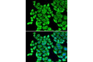 Immunofluorescence analysis of U2OS cells using EEF1D antibody (ABIN5971342). (EEF1D anticorps)