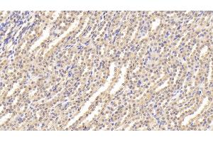 anti-Endothelial Cell-Specific Molecule 1 (ESM1) (AA 22-184) antibody
