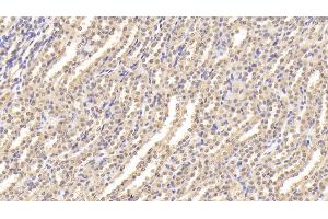 Detection of ESM1 in Rat Kidney Tissue using Polyclonal Antibody to Endothelial Cell Specific Molecule 1 (ESM1) (ESM1 anticorps  (AA 22-184))