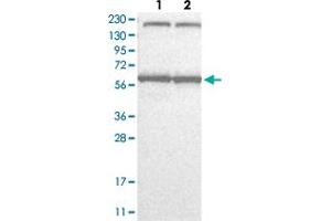 Western Blot analysis with KPNA6 polyclonal antibody  Lane 1: Human cell line RT-4 Lane 2: Human cell line U-251MG sp (KPNA6 anticorps)