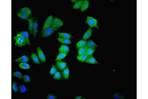 Immunofluorescence staining of HepG2 cells with ABIN7159999 at 1:200, counter-stained with DAPI. (ERK1 anticorps  (AA 11-379))