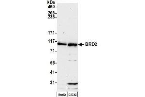 Western Blotting (WB) image for anti-Bromodomain Containing 2 (BRD2) (AA 675-725) antibody (ABIN7453879) (BRD2 anticorps  (AA 675-725))