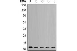 Western blot analysis of NUDT2 expression in SKOV3 (A), HL60 (B), mouse kidney (C), mouse brain (D), rat heart (E) whole cell lysates. (NUDT2 anticorps)