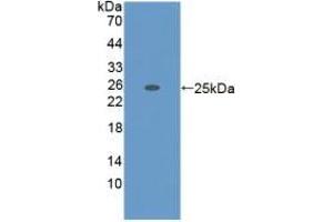 Detection of Recombinant ADAMTS7, Mouse using Polyclonal Antibody to A Disintegrin And Metalloproteinase With Thrombospondin 7 (ADAMTS7)