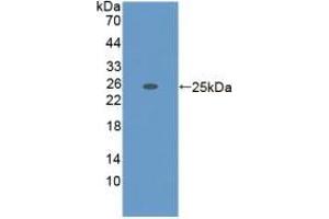 Detection of Recombinant ADAMTS7, Mouse using Polyclonal Antibody to A Disintegrin And Metalloproteinase With Thrombospondin 7 (ADAMTS7) (ADAMTS7 anticorps  (AA 226-437))