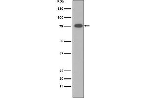 Western blot analysis of Vitronectin expression in human Serum membrane lysate.