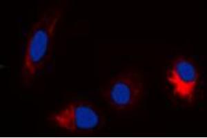 Immunofluorescent analysis of TAU (pS356) staining in Hela cells. (tau anticorps  (pSer356, pSer673))