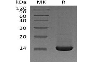 Western Blotting (WB) image for Trefoil Factor 2 (TFF2) protein (His tag) (ABIN7320765)