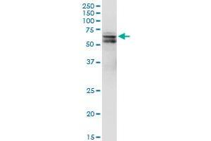 PDPK1 monoclonal antibody (M05), clone 2E2.