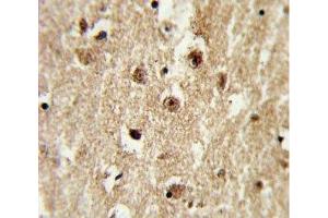 IHC analysis of FFPE human brain tissue with IGFBP2 antibody
