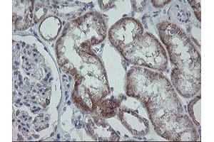 Image no. 13 for anti-Mitochondrial Ribosomal Protein S27 (MRPS27) (AA 151-414) antibody (ABIN1490963)