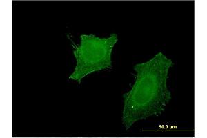 Immunofluorescence of monoclonal antibody to CNP on HeLa cell.