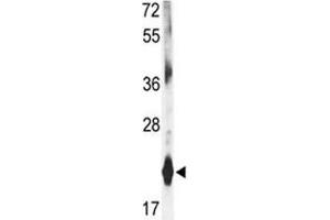 Western blot analysis of DHFR antibody and mouse liver tissue lysate (Dihydrofolate Reductase anticorps  (AA 135-164))