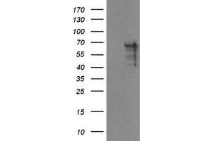 Image no. 7 for anti-SUMO1/sentrin/SMT3 Specific Peptidase 2 (SENP2) (AA 139-523) antibody (ABIN1490927)