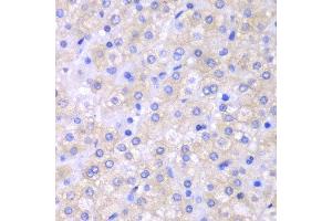 Immunohistochemistry (IHC) image for anti-SH2 Domain Containing 1A (SH2D1A) (AA 1-128) antibody (ABIN3021536)