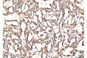 IHC analysis of BHMT using anti-BHMT antibody (ABIN7599940). (BHMT anticorps  (AA 13-386))