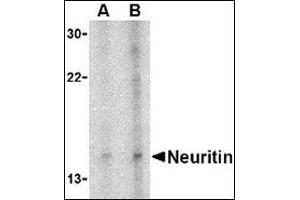 Western blot analysis of neuritin in Daudi cell lysate with this product at (A) 5 and (B) 10 μg/ml. (NRN1 anticorps  (Center))