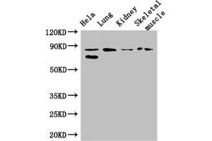 Western Blot Positive WB detected in: Hela whole cell lysate, Mouse lung tissue, Mouse kidney tissue, Mouse skeletal muscle tissue All lanes: PRDM4 antibody at 3. (PRDM4 anticorps  (AA 301-500))