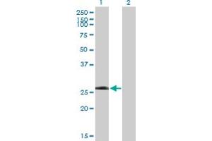 Western Blot analysis of LRRK1 expression in transfected 293T cell line by LRRK1 MaxPab polyclonal antibody. (LRRK1 anticorps  (AA 1-261))