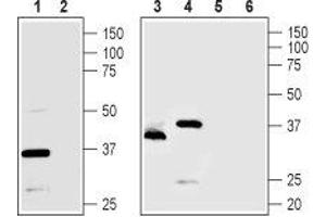 Western blot analysis of rat pancreas (lanes 1 and 2), Mouse MS1 endothelial cells (lanes 3 and 5) and human PANC1 pancreatic carcinoma cells (lanes 4 and 6) lysates: - 1,3,4. (TMEM66 anticorps  (Intracellular, Lumenal Region))