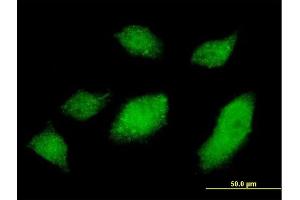 Immunofluorescence of monoclonal antibody to UBQLN1 on HeLa cell.