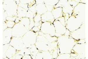 ABIN6274825 at 1/100 staining Human lung tissue by IHC-P.