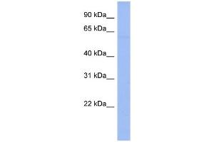 WB Suggested Anti-DTX1 Antibody Titration:  0. (Deltex Homolog 1 anticorps  (N-Term))