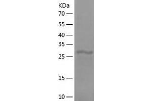 Western Blotting (WB) image for Complement Component C4b (C4b) (AA 1454-1744) protein (His-IF2DI Tag) (ABIN7122473)