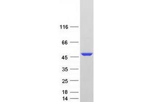 Validation with Western Blot