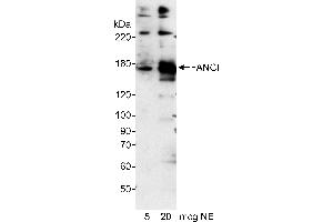 Western Blotting (WB) image for anti-Fanconi Anemia Complementation Group I (FANCI) (AA 200-250) antibody (ABIN7449597)