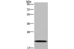 Western Blot analysis of Raji cell using NDUFAF4 Polyclonal Antibody at dilution of 1:300 (NDUFAF4 anticorps)